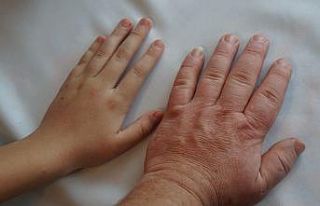 Yüzüğünüz parmağınıza, ayağınız ayakkabınıza...