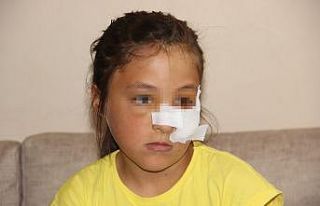 Amcaoğlu küçük kıza demir boruyla dehşeti yaşattı