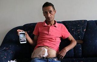 Bağırsakları vücudunun dışında olan adam yardım...
