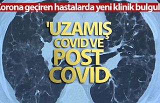 Covid Virüsü geçirenler de yeni bulgu: 'Uzamış...