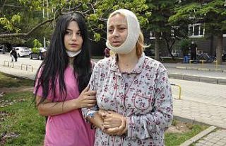 Eskişehir’de darp edildiği iddia edilen kadın...