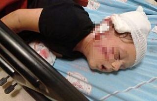 Minik Yağız’ın köpeğin saldırısına uğrayıp...