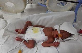 850 gram doğan Müge bebek, hayata tutunmayı başardı