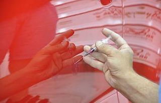 Araç çiziklerini kapatmada yeni yöntem