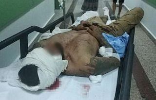 Bıçaklı saldırıda yaralandı