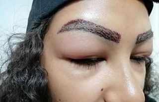 Reklam yüzü olmak için gitti, yüzünden oldu