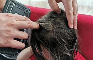 Sokak köpeği 6 yaşındaki kız çocuğuna dehşeti...