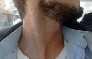 A Haber ekibine otoparkta saldırı