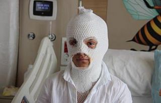 Camide çıkan yangını söndürmeye çalışırken...