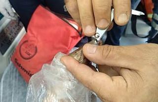 Isparta’da parmağı pasta aparatına sıkışan...