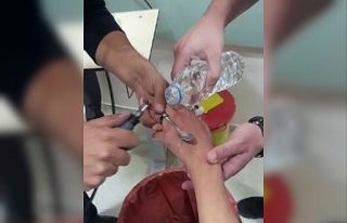 Elazığ’da itfaiyeden yüzük çıkarma operasyonu