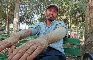 Hastalığına alıştı, insanların kendisinden...