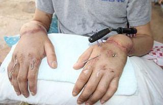 Kestirmediği ellerini yeniden kullanmak istiyor