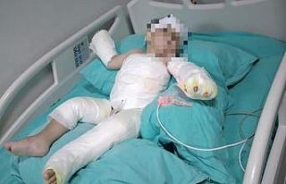 Kolonyalı vahşetin şüphelisi babadan ilginç ifade:...