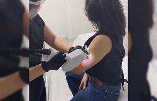 Lazer epilasyon ile istenmeyen tüylere kalıcı çözüm