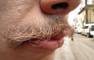 (Özel) Gören inanamıyor, sadece bıyıkları sarı