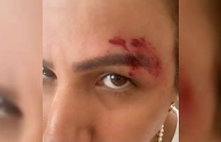 Zafer Parti’li Çelik’in "Suriyeliler saldırdı"...