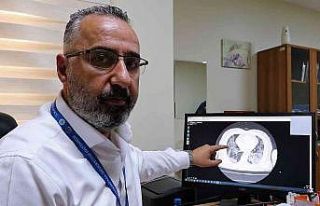 Aşısız hastaların akciğer tomografisini paylaşarak...