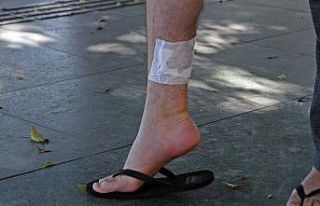 Kızına balon almak isterken köpeğin saldırısına...