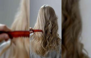 “Kök hücre tedavisiyle saç dökülmesini durdurulabilir”