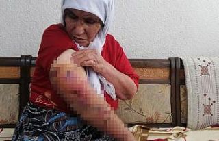 Köpeğin saldırısına uğrayan kadın ölümden...