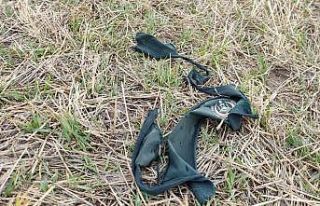 10 köpeğin saldırısına uğrayan çocuğun olay...