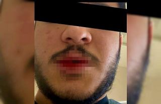 Kars’ta sağlık çalışanı darp edildi