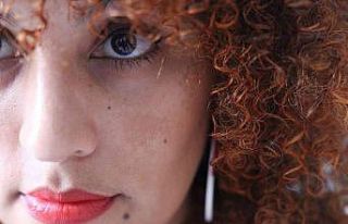 ’’Leke tedavileri uzun solukludur ve sabır gerektirir’’