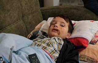 Sokak köpeğinin saldırısına uğrayan çocuk ölümden...