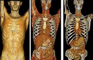 Tıbbın gören gözleri ve görünmeyen emekçilerinin...