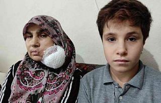Yüzündeki dev kitleden kurtulmak için yardım bekliyor