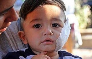 11 aylıkken pitbull saldırısına uğrayan minik...