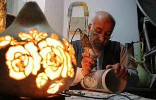 3 defa kalbi durdu, felç geçirdi ama o hobisi sayesinde...