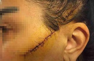 Eski sevgilisinin yüzünü usturayla kesen adam tutuklandı