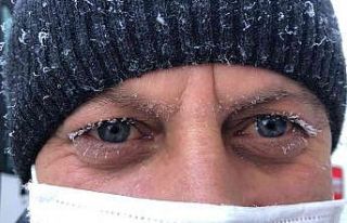 Kars’ta soğuktan vatandaşın kirpikleri buz tuttu