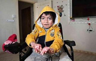 Kelebek hastası Seyfettin parmaklarına kavuştu