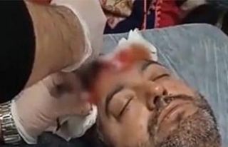 Avukata beyzbol sopalı saldırıda bulunan sanık...