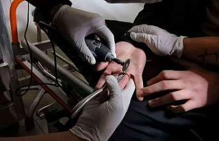 Bursa’da ilginç olay: Parmağına 1 TL sıkıştı