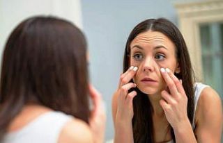 Göz altı halka ve torbalarınızdan kurtulun