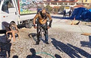 Her yeri yandı, hiçbir şey olmamış gibi derdini...