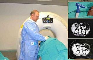 Karaciğer kanseri tedavisinde ‘Mikrodalga Ablasyon’...