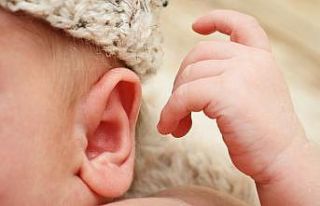 Silikon kalıplar ile kulak bozuklukları haftalar...