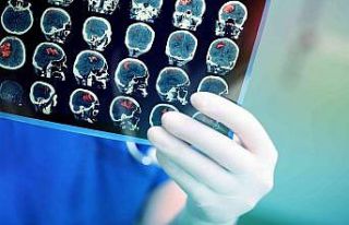 Yeni cerrahi teknolojiler beyin tümörü ameliyatlarındaki...