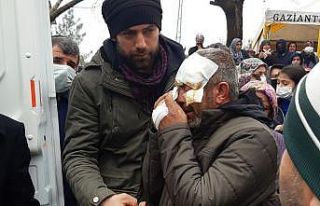 Yüzü gözü sargılar içerisinde, kazada ölen...