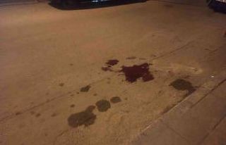 Ankara’da silahlı saldırı sonucu bir vatandaş...