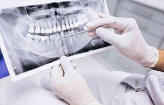 Sigara, diş tedavi sürecini olumsuz etkiliyor