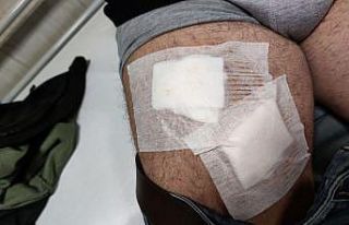 Tarladaki çiftçi köpeklerin saldırısına uğradı