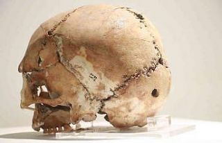 Dünyanın ilk beyin ameliyatı 10 bin 500 yıl önce...