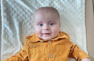 200 binde bir görülen hastalıkla doğan bebek annesinin...