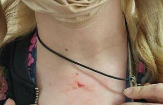 65 yaşındaki kadın sağlık çalışanını boğazından...